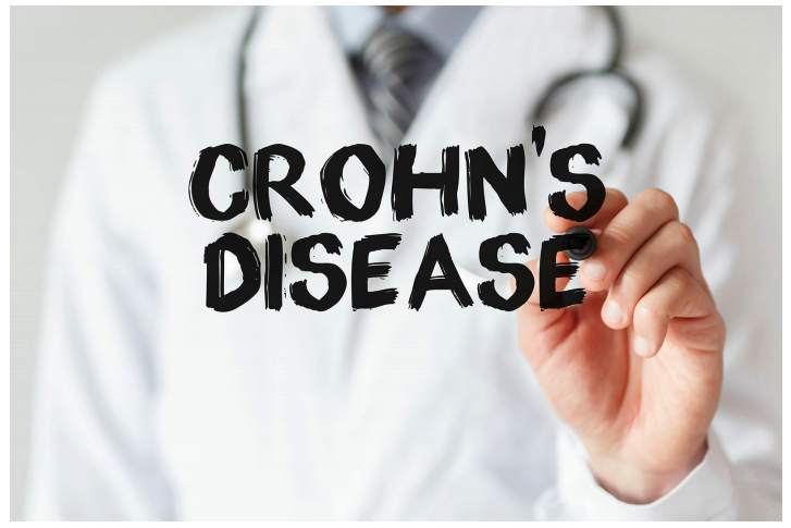 crohns_disease.png